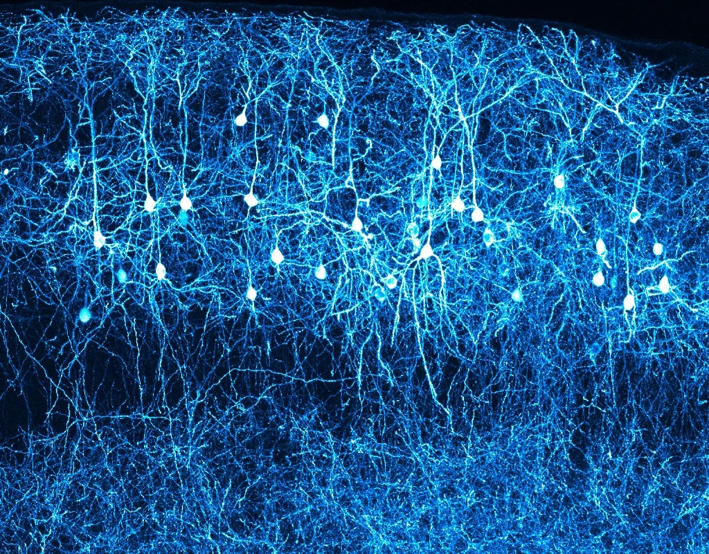 神经元中的基因表达解决了大脑进化难题